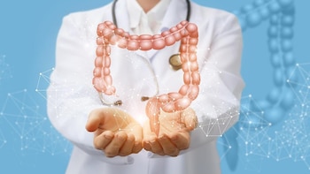 El cáncer de colon está aumentando entre los adolescentes