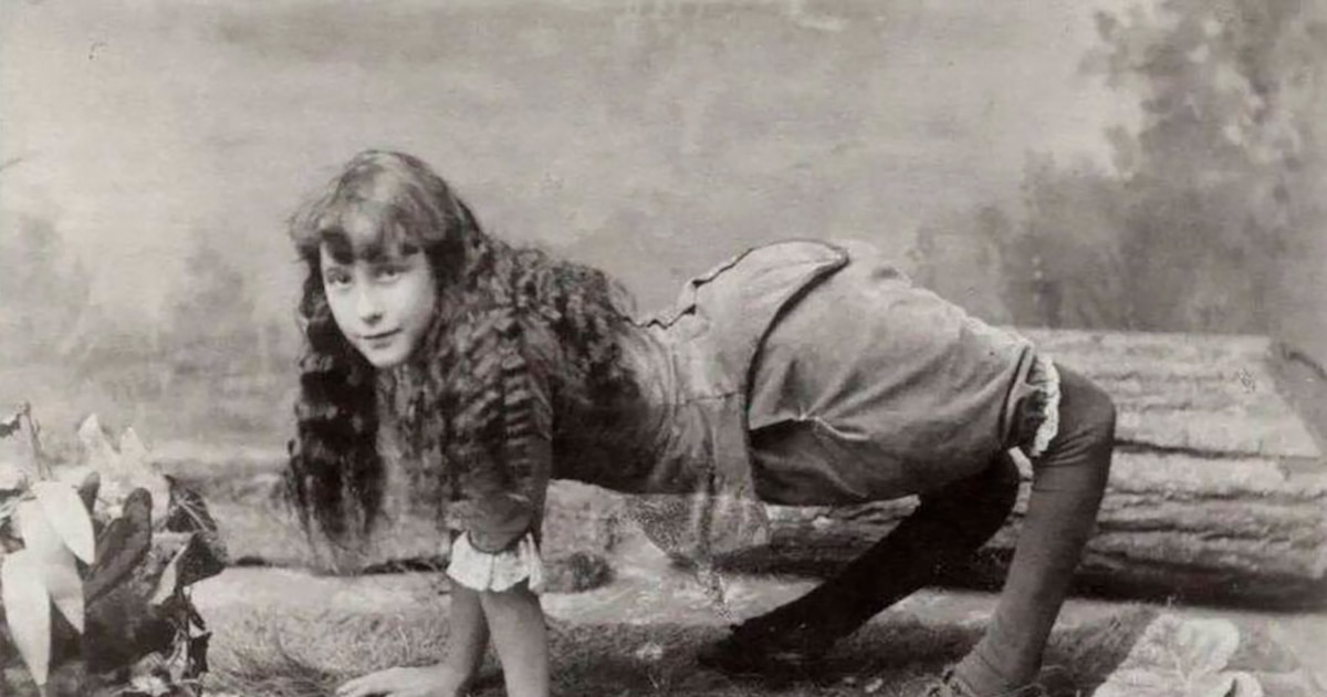 La Conmovedora Historia de Ella Harper, la "Niña Camello" que Desafió los Circos de Fenómenos
