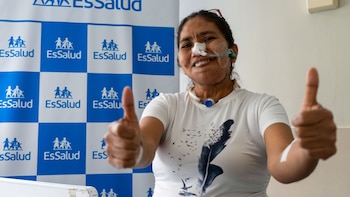 Paciente recupera la sonrisa tras reconstrucción mandibular con hueso de su propia pierna