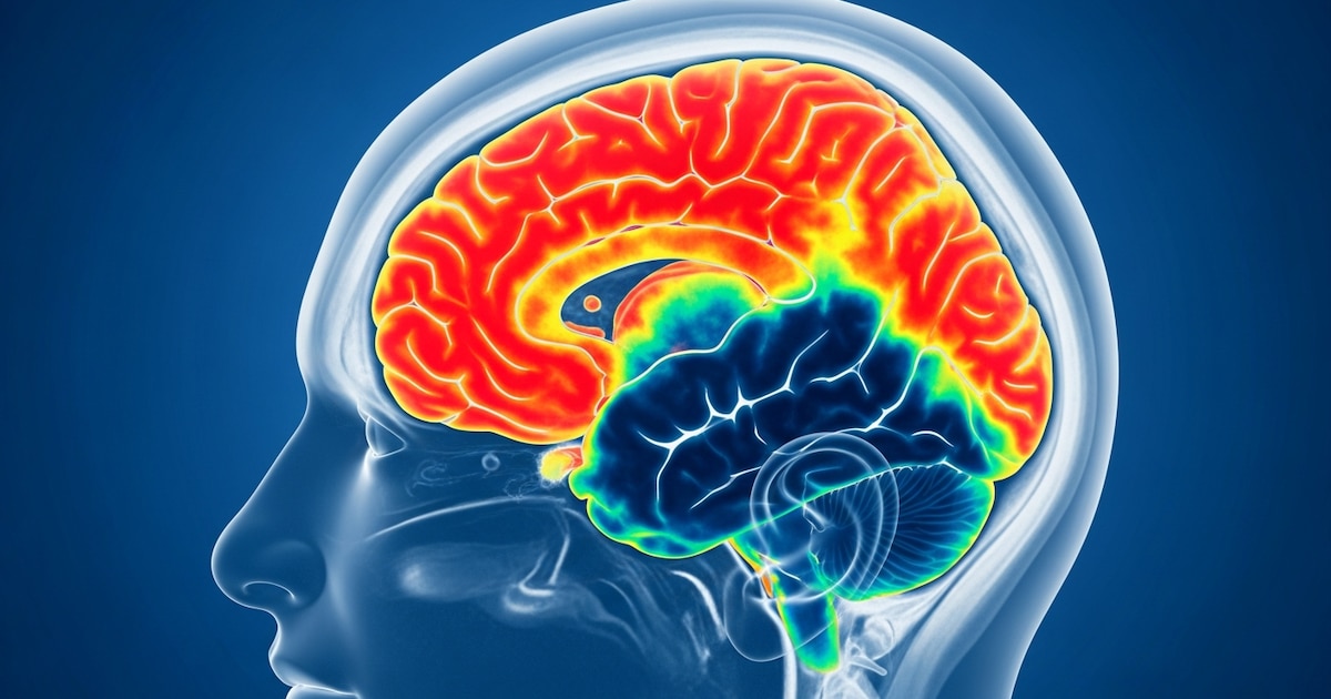 Demencia Frontotemporal: Nueva técnica detecta daño cerebral temprano