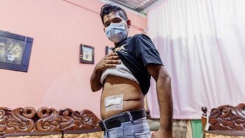 Extirparon un tumor del tamaño