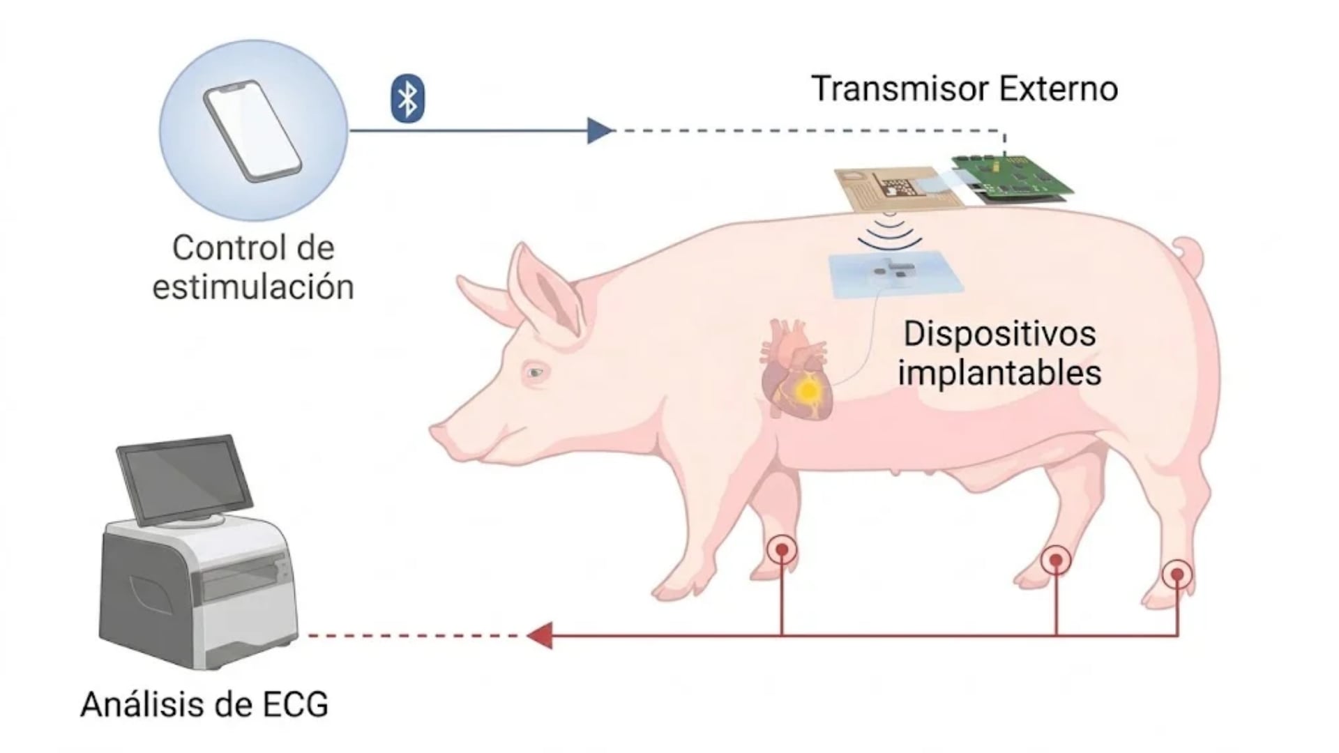 Este diagrama detalla el funcionamiento de un sistema inalámbrico de energía para implantes cardiacos probado en modelos porcinos (Gentileza, estudio A wearable-to-implant wireless power transfer technology with variation tolerance, publicado en Nature Electronics / Imagen Ilustrativa Infobae )