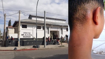 Un adolescente con epilepsia recibió una brutal paliza de sus compañeros de escuela en Córdoba