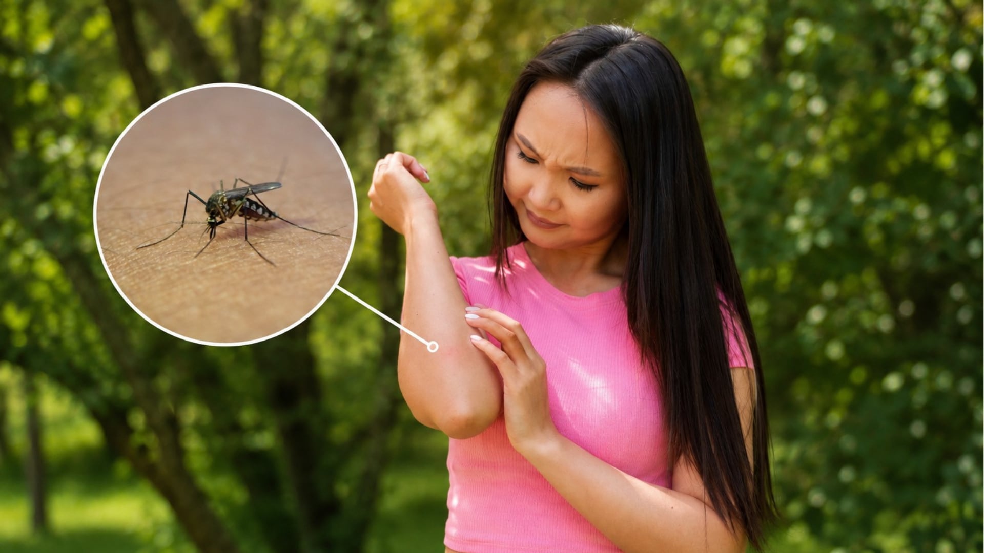 Una persona se rasca el brazo debido a una picadura de mosquito, con una vista ampliada que muestra un Aedes aegypti, en el contexto de las campañas de prevención del dengue en América Latina.
