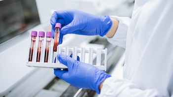 ¿Cuál es el factor sanguíneo