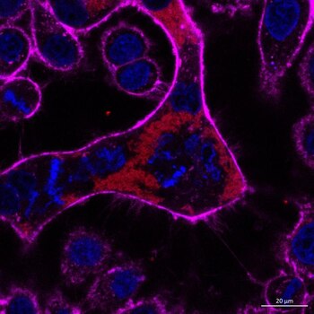 La bacteria Burkholderia pseudomalle suele