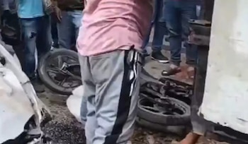 Uno de los heridos en el siniestro sufrió fracturas en ambas manos y requiere una intervención quirúrgica - crédito Captura de video