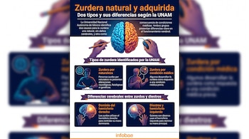 Infografía sobre zurdera natural y adquirida con imágenes de un cerebro, manos izquierda y derecha, personas escribiendo y texto explicativo.