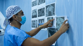 La planificación con modelos impresos en 3D permitió realizar cortes precisos y adaptar el injerto óseo para recuperar la estructura facial de la paciente - Créditos: Essalud.