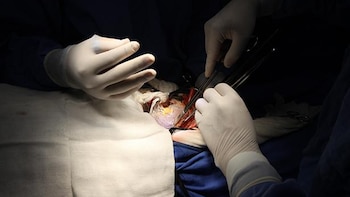 Tips Jurídicos: ¿puedo elegir a quién donar un órgano?