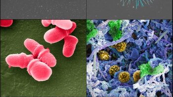 Les « bons » virus pourraient-ils nous