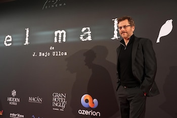 Imagen 3VBOM3COQJF4NH5LPSCKAOG7W4