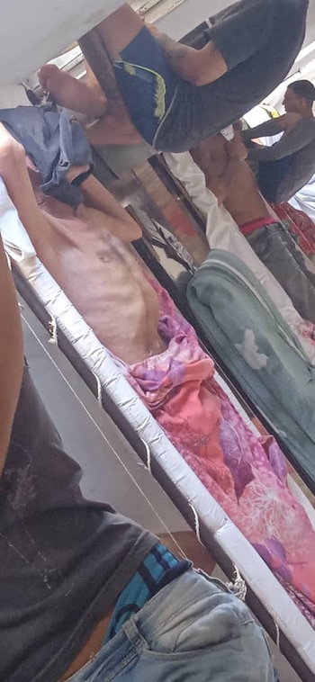 Desnutrición en Las Mangas, Bayamo