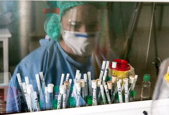 EFE/EPA/CSABA KRIZSAN