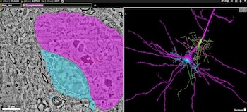 Mapa cerebral Google Harvard