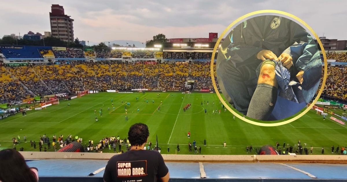 ¡Emergencia en el Estadio Ciudad de los Deportes! Aficionado de América Resulta Herido y Se Denuncian Graves Fallas de Seguridad