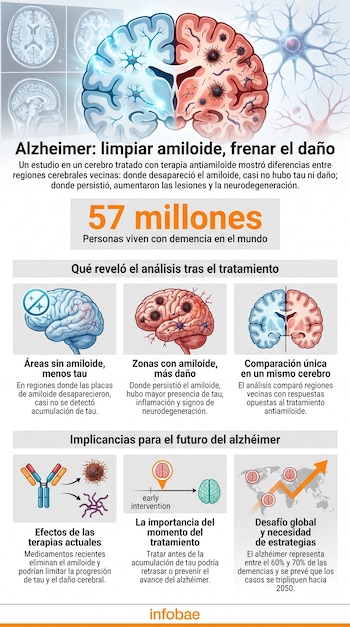 Infográficos com varreduras cerebrais, seções cerebrais, neurônios, mapas de proteínas e anticorpos e um mapa mundial com dados de Alzheimer.