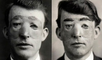 Walter Yeo tenía 25 años. Había nacido en Plymouth en 1890, y el mar era parte de su vida desde niño