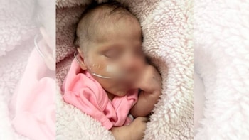 Un bebé recién nacido recostado con los ojos cerrados y una cánula nasal en el rostro, envuelto en una manta rosa afelpada