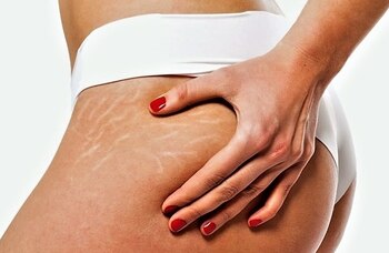 Su uso regular puede ayudar