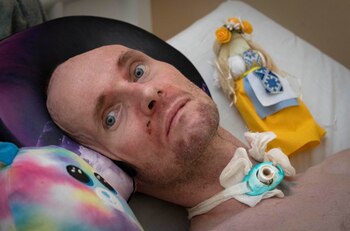 Un padre amoroso y su hijo herido pagan los costos de la guerra en Ucrania