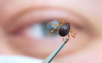 ARCHIVO - Las garrapatas son pequeñas, pero peligrosas, porque transmiten enfermedades graves. Foto: Marijan Murat/dpa