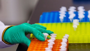 Científicos crearon una “biblioteca” de mutaciones de ADN para estudiar el envejecimiento y la longevidad