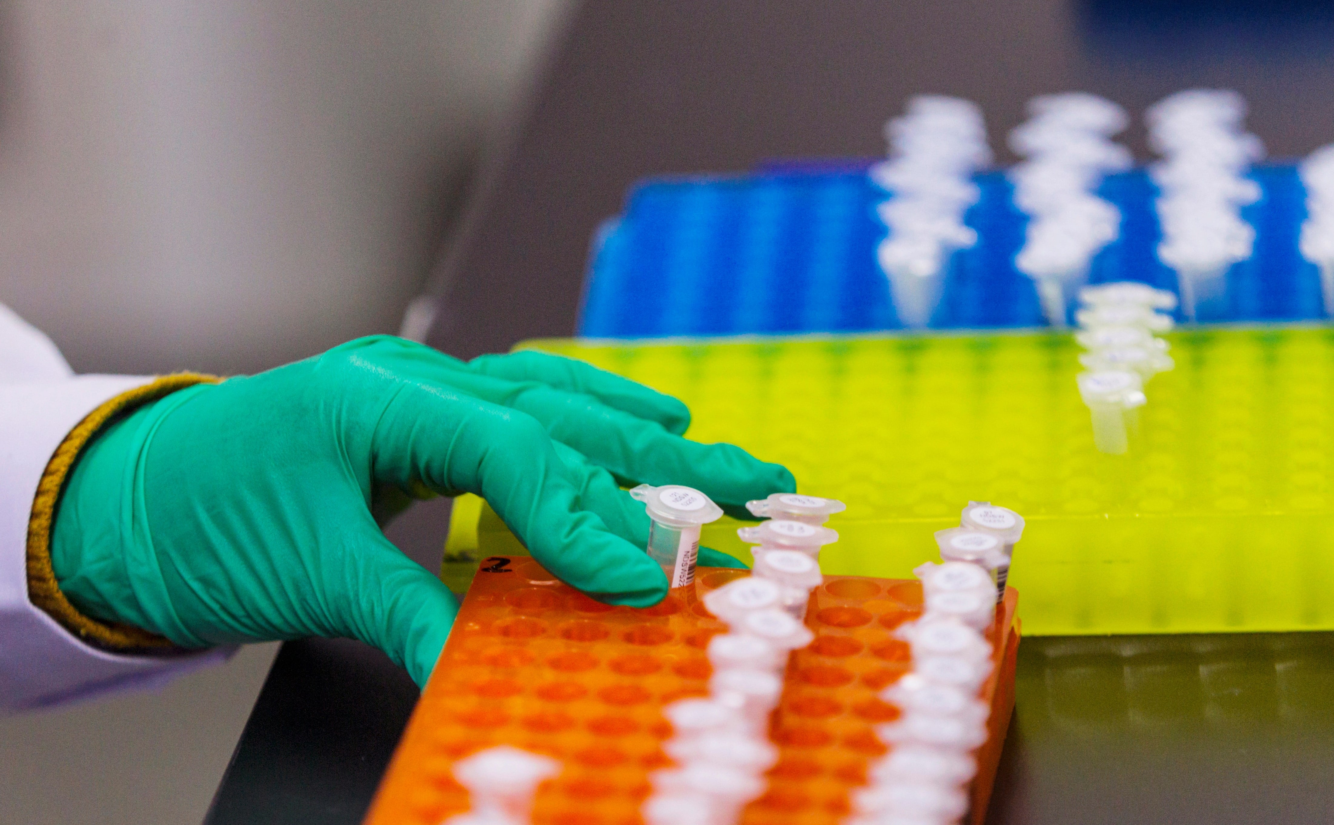 La herramienta desarrollada permitirá analizar tanto mutaciones hereditarias como las inducidas por estrés ambiental o envejecimiento./Archivo EFE/ Aleksandar Plavevsk