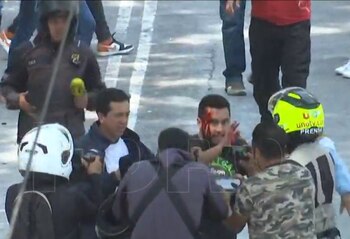 Una de las personas lesionadas