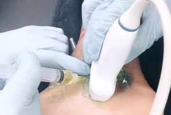 La inyección Alexis Vega tras su lesión con Selección Mexicana en el inicio de su recuperación (Foto: Instagram/@alexisvega.9)