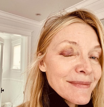 Michelle Pfeiffer lució un ojo