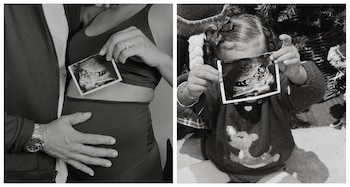 Ana Peleteiro en una imagen