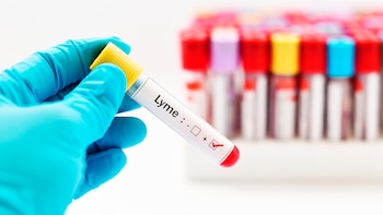 Los primeros síntomas aparecen entre