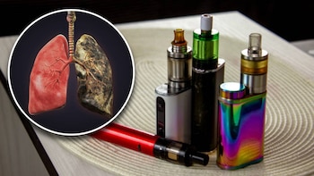 Vapeadores: los artefactos que deterioran