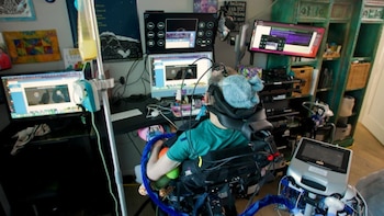 Un hombre con ELA logró mejorar el habla y comunicarse gracias a un implante cerebral autónomo