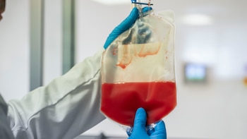 El riesgo de cáncer secundario