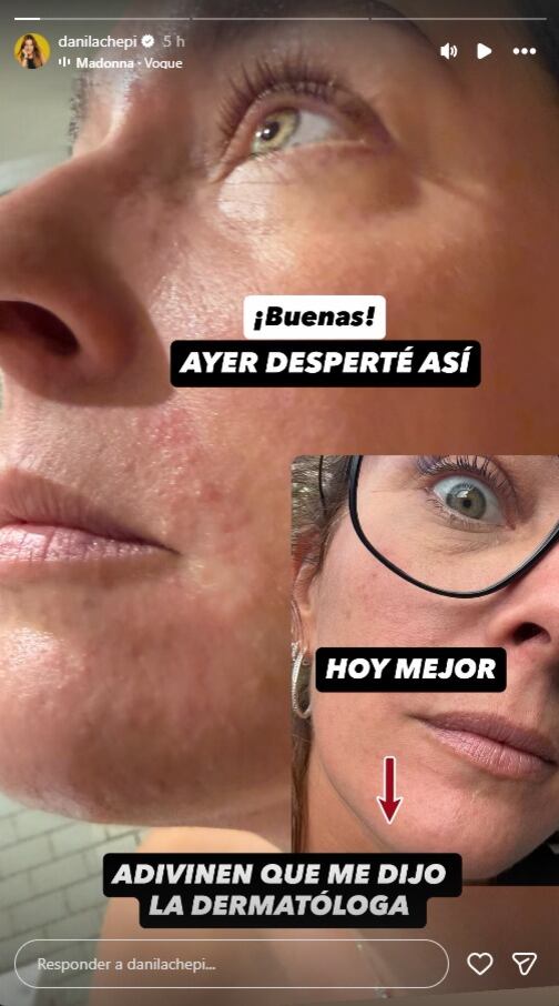 Dani compartió la reacción que tuvo su rostro a los altos niveles de estrés