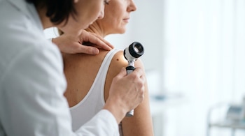 Primer plano de un profesional de la salud con bata blanca examinando un lunar en el hombro de una mujer adulta con un dermatoscopio, sobre un fondo desenfocado.