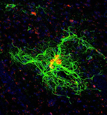 Tras evaluar el caso, los