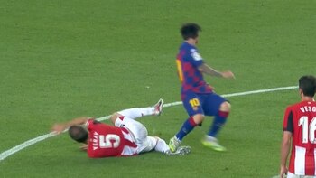 El pisotón de la polémica,