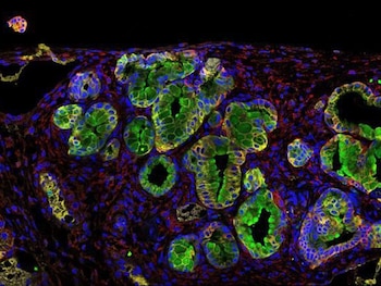 Administrar quimioterapia a las personas