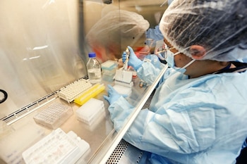 COVID-19: Perú registró 485 nuevos