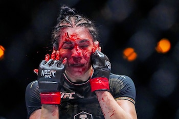 SENSITIVE MATERIAL. THIS IMAGE MAY OFFEND OR DISTURB Sep 14, 2024; Las Vegas, Nevada, USA; Irene Aldana of Mexico (red gloves) fights Norma Dumont of Brazil (blue gloves) during Riyadh Season Noche UFC 306 at The Sphere. Mandatory Credit: Stephen R. Sylvanie-Imagn Images TPX IMAGES OF THE DAY