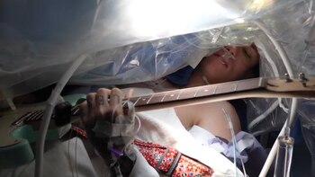 Un guitarrista guió a neurocirujanos
