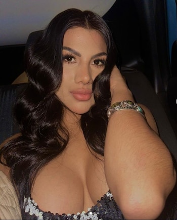 Brunella Torpoco se sometió a