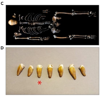 Estudio hombre del pozo