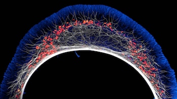 Otra de las microfotografías logradas