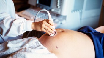 El estrés materno durante el