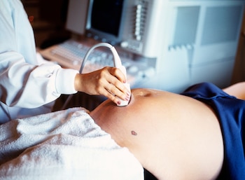 La mujer embarazada común necesita