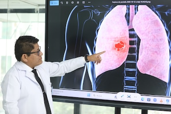 Cáncer al pulmón en Perú
